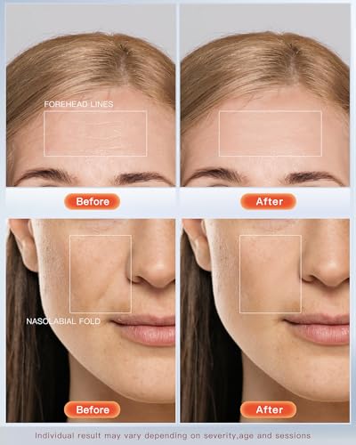 Claréa Anti-Aging Face Massager – Lift, Firm & Glow