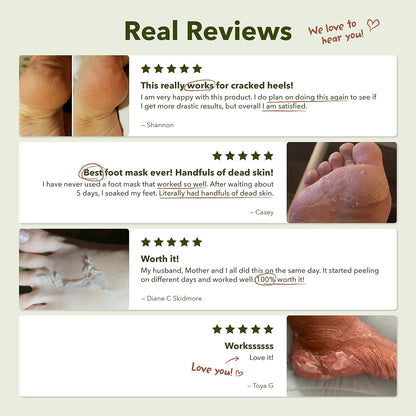 Claréa Foot Peel Mask 6 Pack – Exfoliating Mask for Calluses, Cracked Heels & Dry Skin
